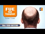 How to find the top hair transplant surgery clinic in Pakistan doing FUE hair transplant?