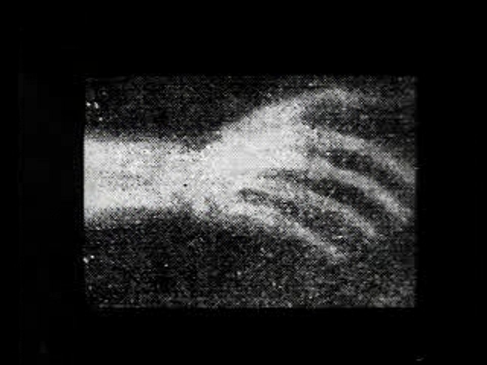 Indirect X-RAY shots 1911