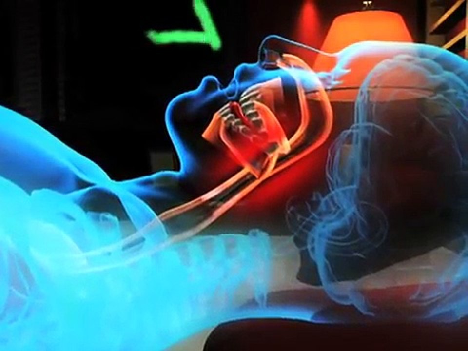 Stop Snoring Instantly - Bob Eubanks ZYPPAH Commercial