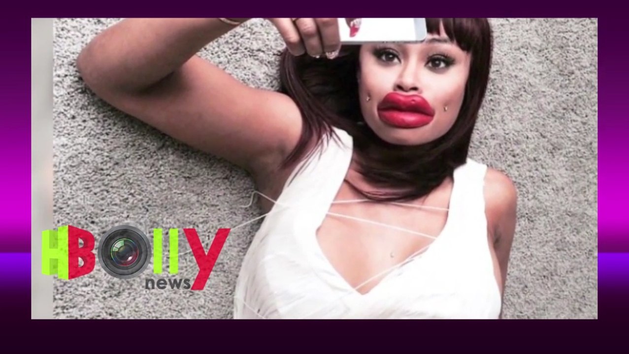 Hollywood Models Lips Surgery Goes Wrong  OMG its Horrible