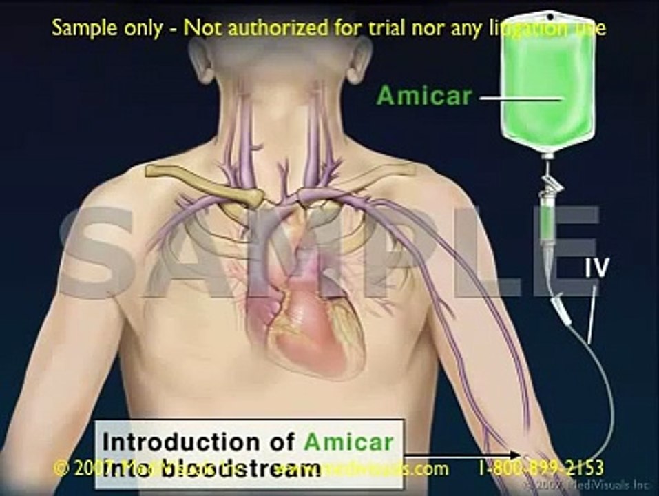 Clot Formation and Clot Breakdown: 2D Medical Animation