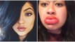 Kylie Jenner's Big Lips Secret... Larger Lips Gone Wrong