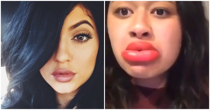 Kylie Jenner's Big Lips Secret... Larger Lips Gone Wrong