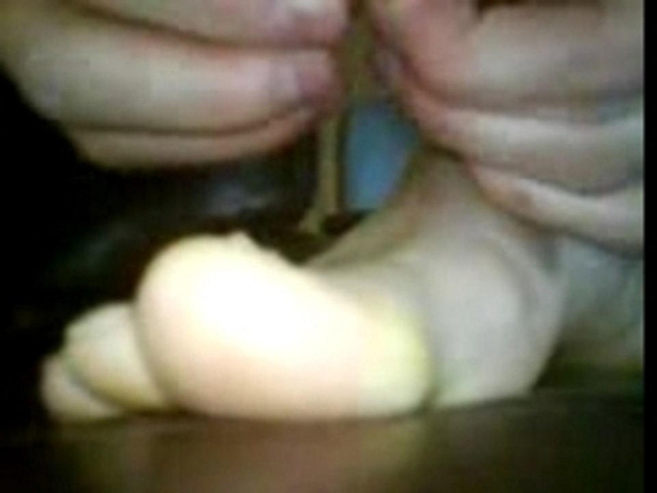 Big toe nail