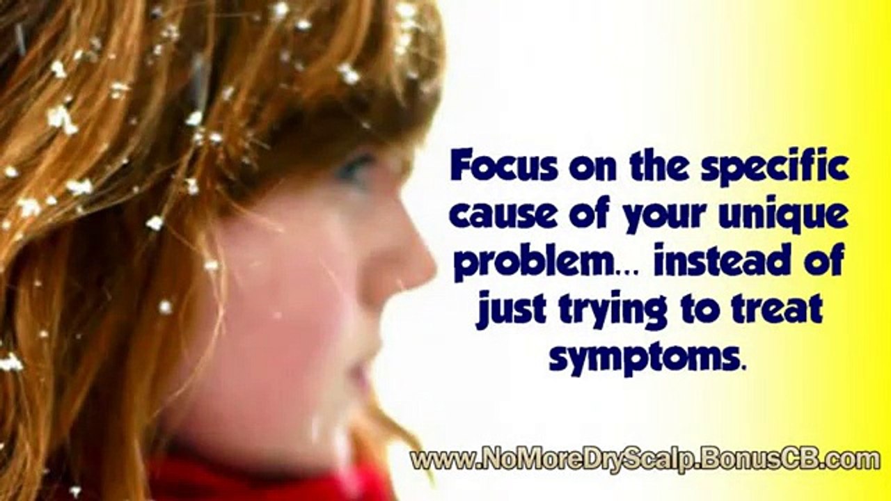 no more dry scalp - dandruff treatment - home remedies for dandruff