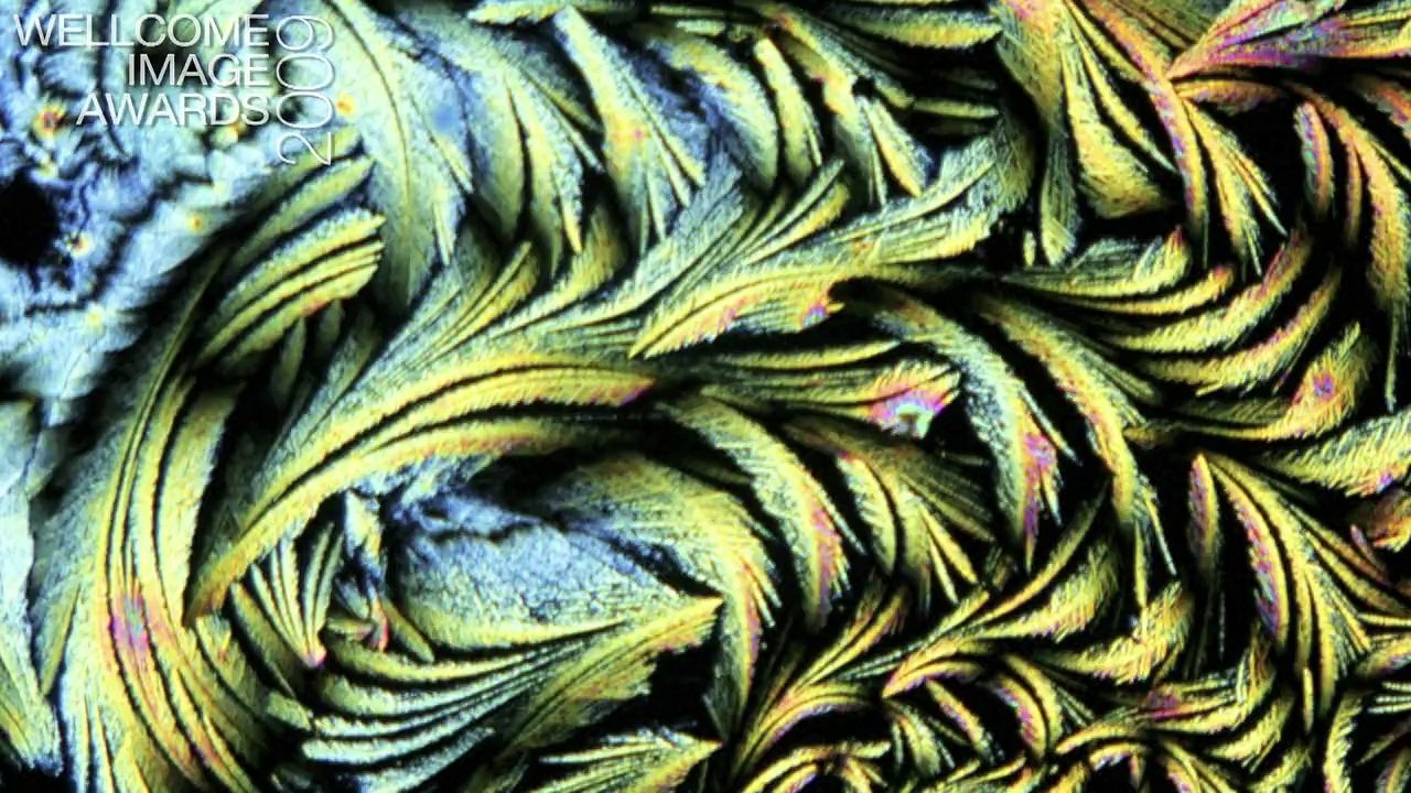 Light microscopy - Wellcome Image Awards 2009