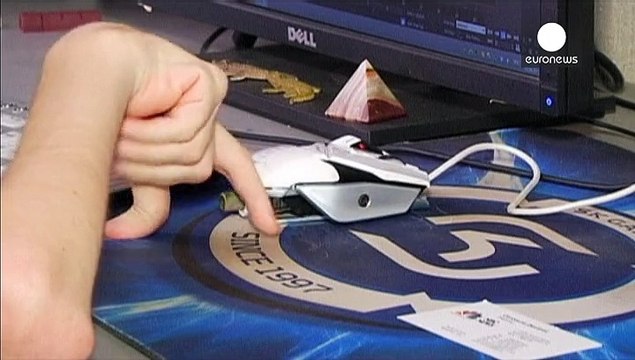 روسيا: شاب يعاني من مرض نادر يتطوع لعملية زراعة الرأس