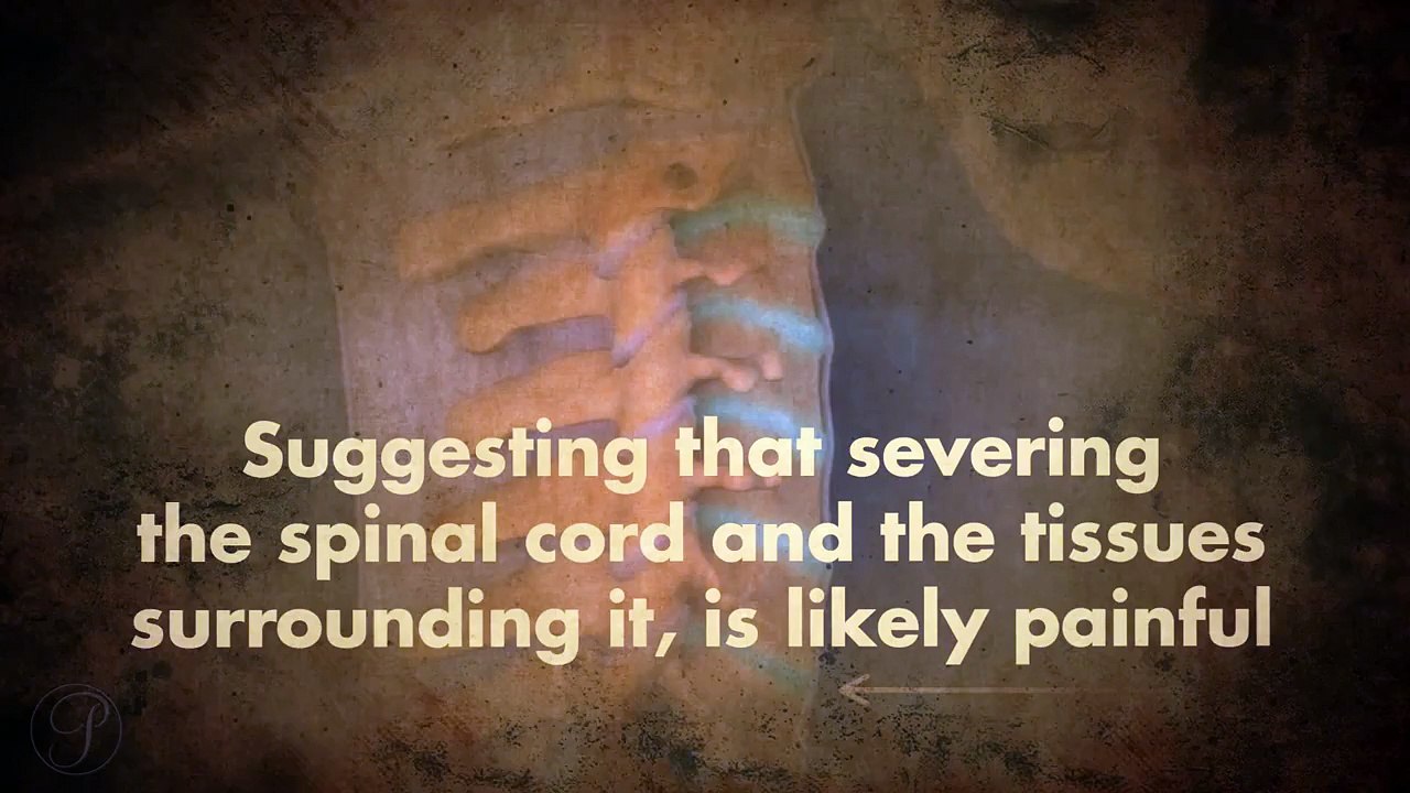 Do Decapitated People Stay Conscious After Decapitation?