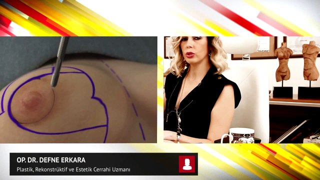 Op. Dr. Defne Erkara meme küçültme ameliyatı hakkında bilgiler veriyor...