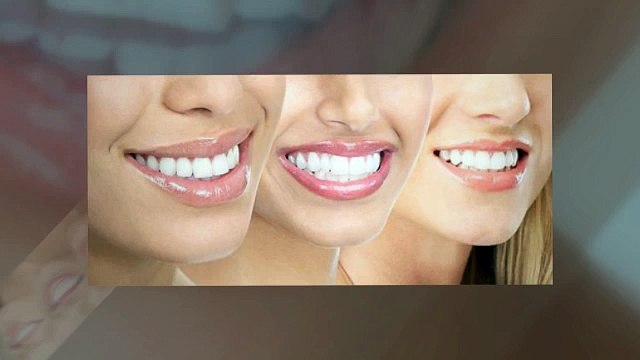 Bella Labs Teeth Whitening System