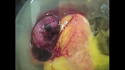 MUCİZEYE ŞAHİT OLMAK İSTER MİSİNİZ