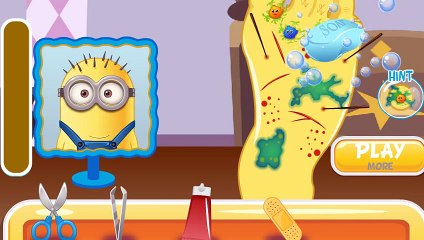 ▐ ╠╣Đ▐► Minion foot doctor emergency game - Minion injured her foot