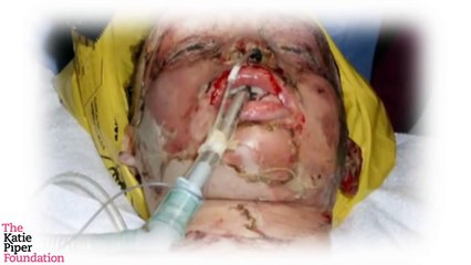 The Katie Piper Foundation Trailer