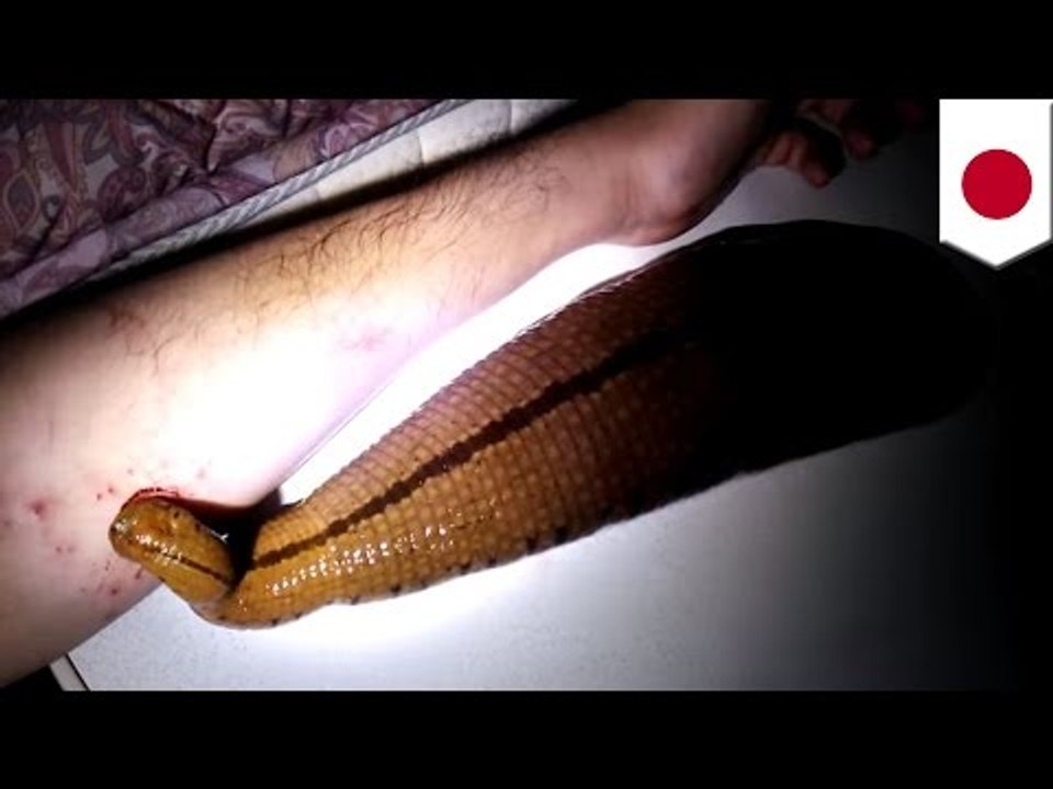 BEURK! Une vidéo montre un Japonais laisser une sangsue géante lui sucer le sang