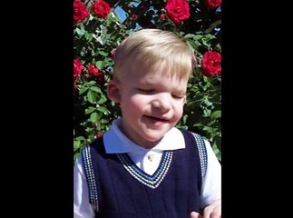 Mowat-Wilson Syndrome