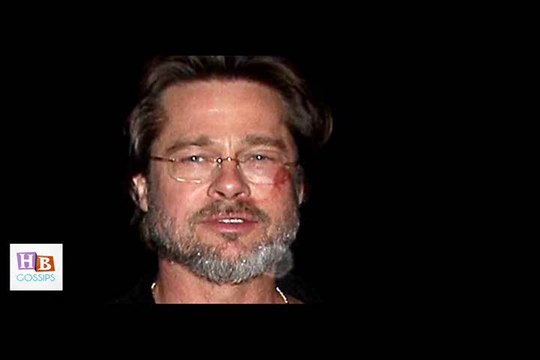 Brad Pitt Blames Face Scrape on Wearing Flip Flops 2015