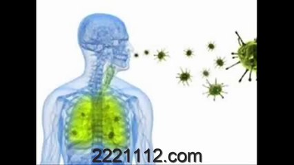 PNEUMONIA Bacterial -  اردو