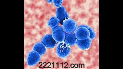 PNEUMONIA Bacterial 5 - اردو