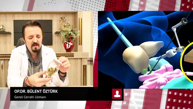 Op.Dr.Bülent ÖZTÜRK - Genel Cerrahi Uzmanı - Safra Kesesi Hastalıkları ve Ameliyatları Hakkında Bilgiler Veriyor ...