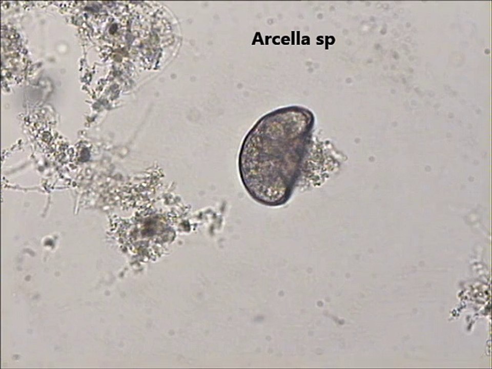 Arcella sp
