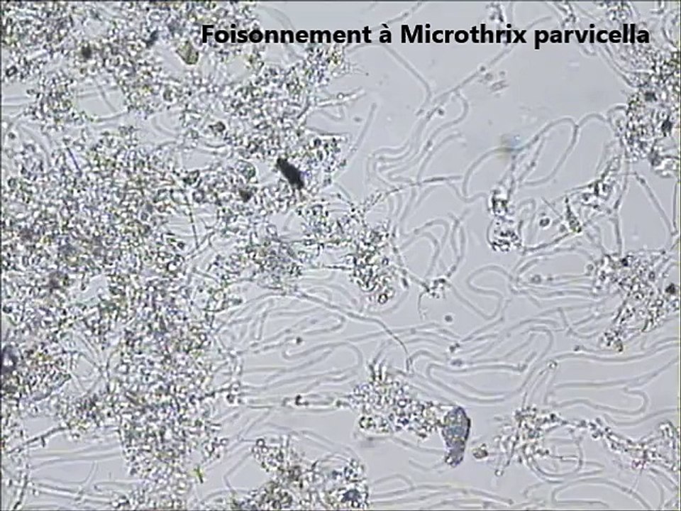 Microthrix parvicella