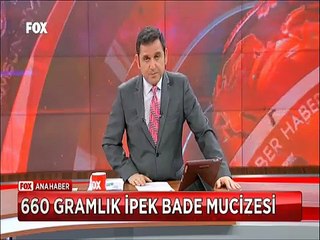 660 gramlık İpek Bade mucizesi yaşamaz denilen İpek'i annesi organik gıdalarla nasıl yaşattı