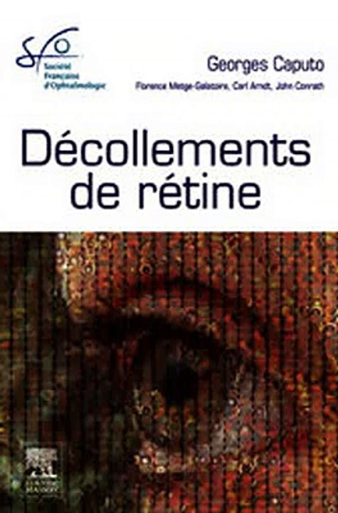Download Décollements de rétine Ebook {EPUB} {PDF} FB2
