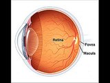retina, retina tedavisi,retina yırtılması,retina hastalıkları,retina yırtılması ameliyatı,