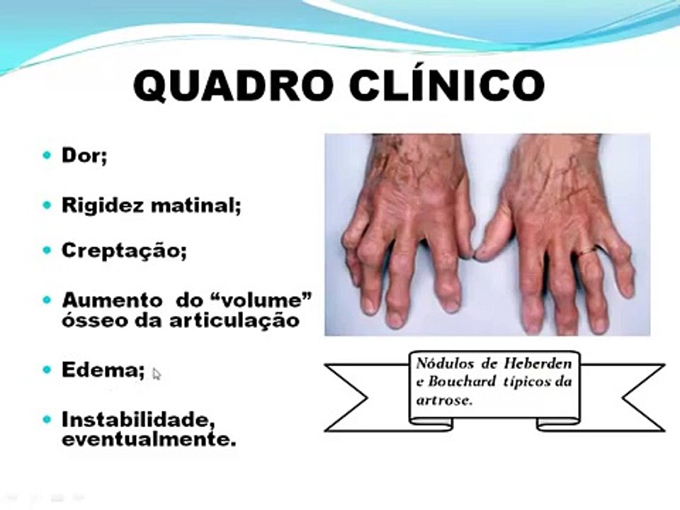 Aula artrose