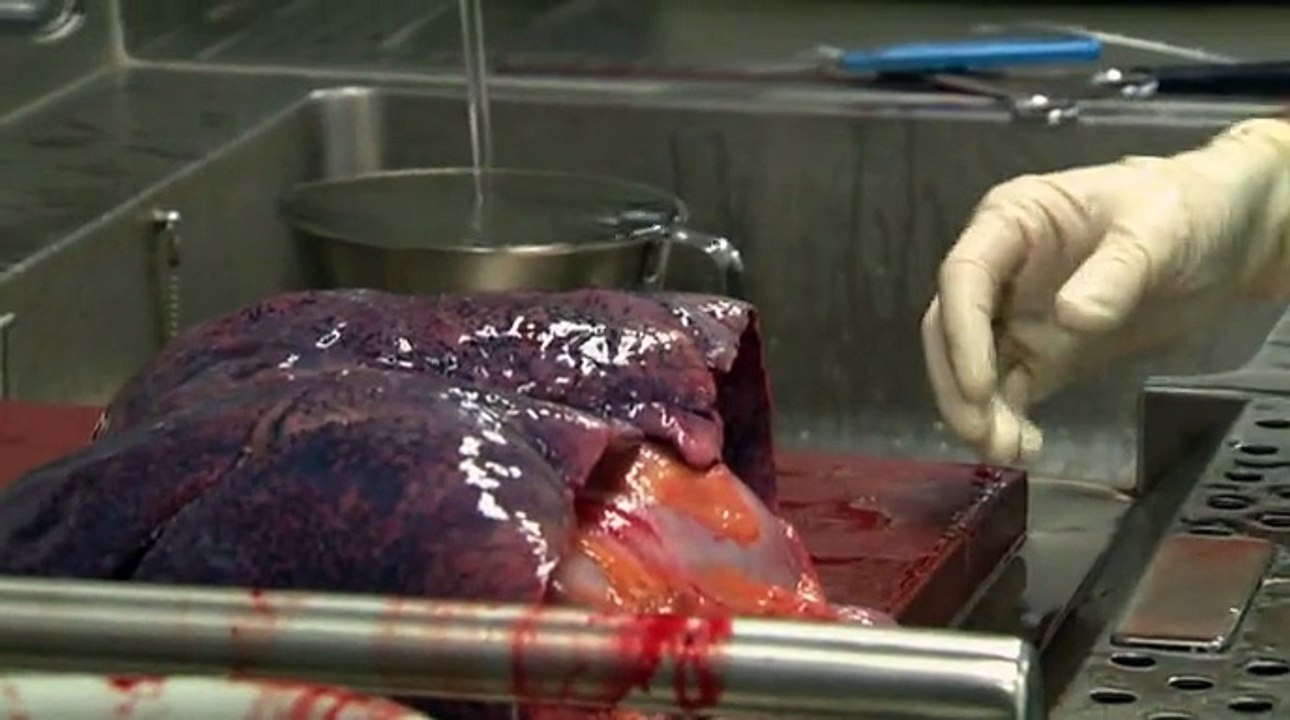 BBC Life In The Mortuary