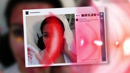 Hollywood News: Kim Kardashian Tries Blood Facial To Look Younger-- KY Network