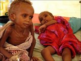 Children in Africa are Starving to Death