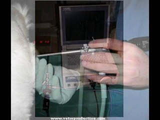 Insémination artificielle intra-utérine sous endoscopie.