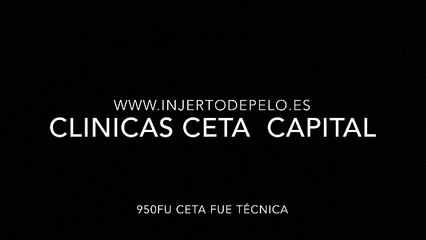 CLINICAS CETA CAPITAL www.injertodepelo.es