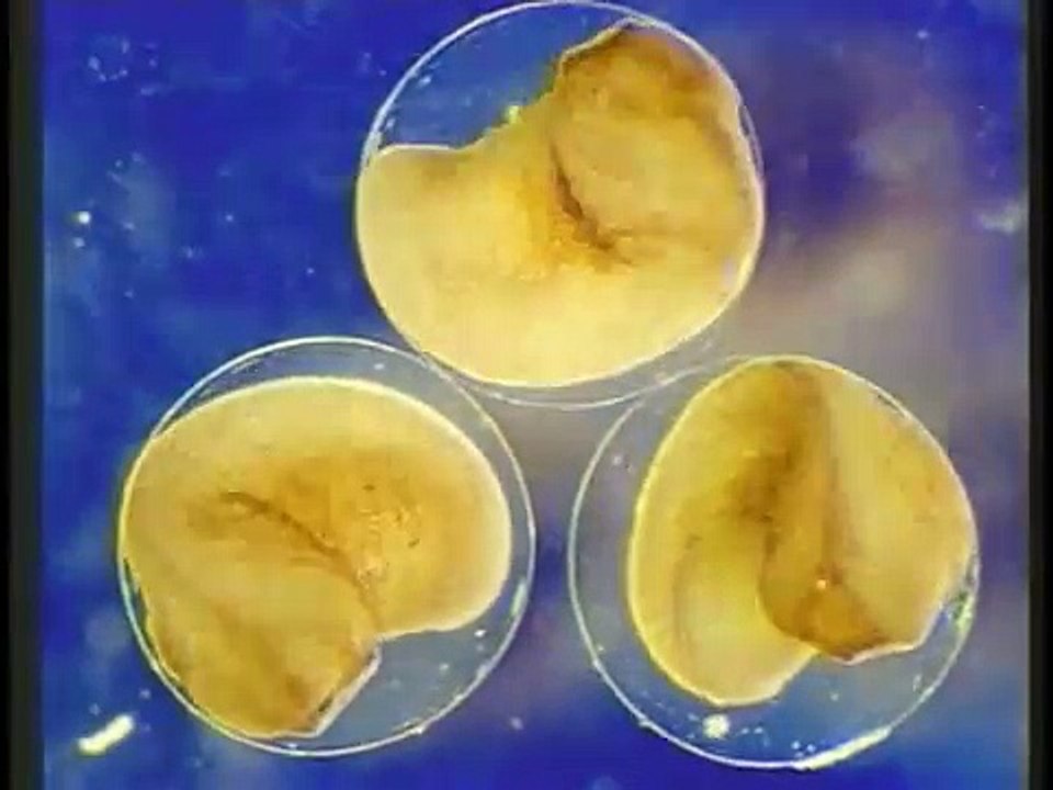 Embryo development in worm and fish