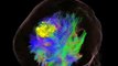 New generation neuroimaging:3D multi-modality hybrid imaging