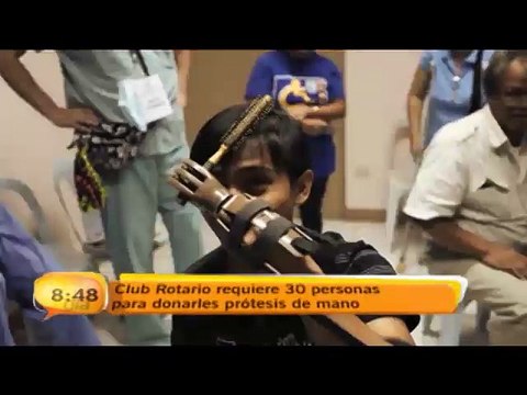 bd-protesis-mano-100315