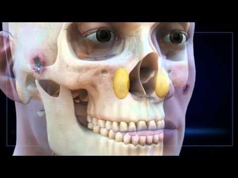 清百塊碎骨 連勝文開口講話 2010.11.28