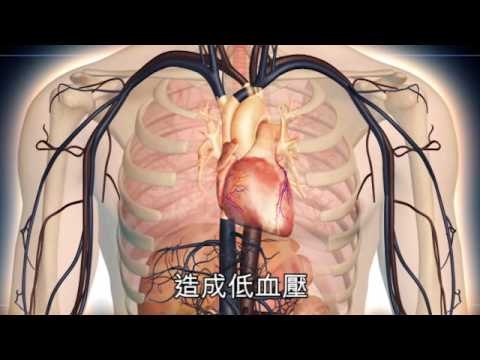 NMA 2009.12.18 動新聞 吃檳榔王 男子變植物人