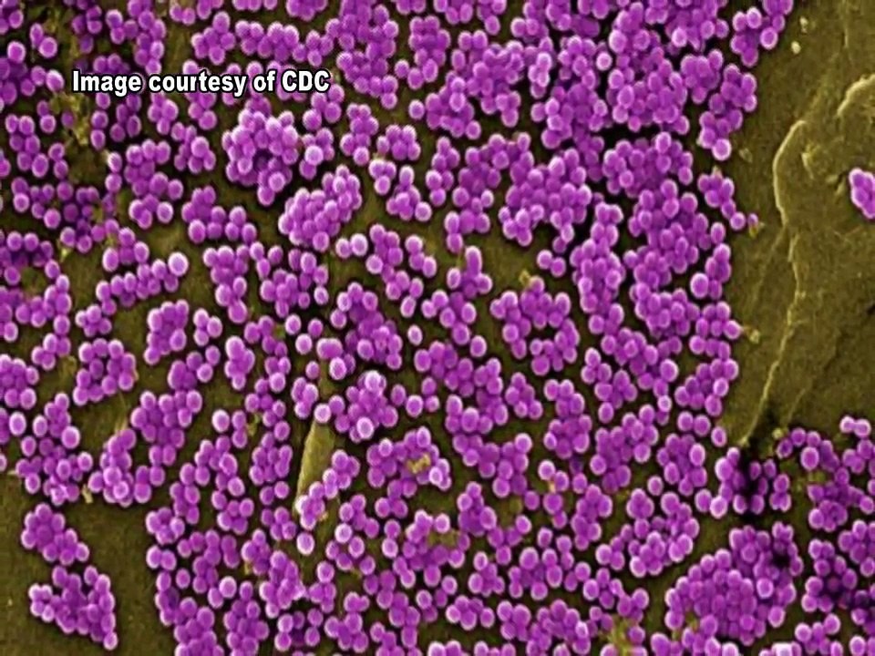 Staphylococcus aureus