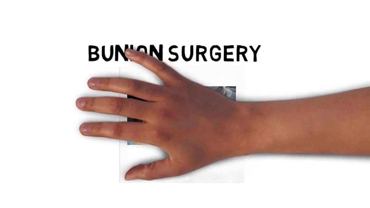 Foot Doctor Edmonton | Best Podiatrist Clinic and Surgery (bunion) - YouTube [360p]