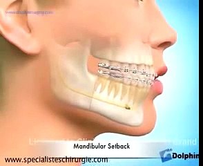 جراحی فک و ارتودنسی | دکتر مسعود داودیان