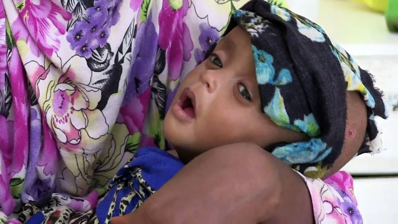After Somalia's famine, hunger persists