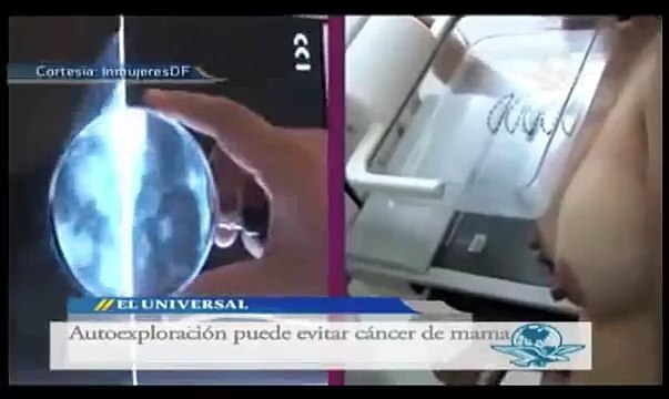 Autoexploración, clave para detectar el cáncer de mama