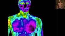 Infrared Camera (Thermal Imaging) - ICE BATH