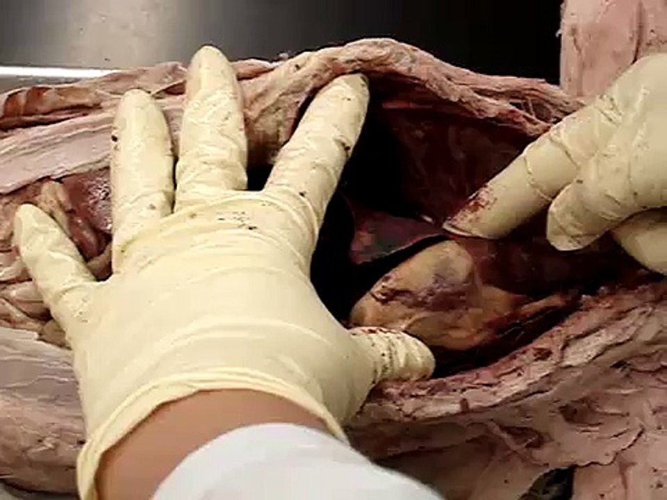 abdomen dissection