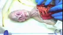 shocking video of alien autopsy in Russia in 1969 UFO OVNI. (autpsia a alien en rusia en 1969)