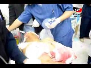 «المصري اليوم» ترصد لحظات الدم بمستشفيات الدقهلية بعد «انفجار المنصورة» +18