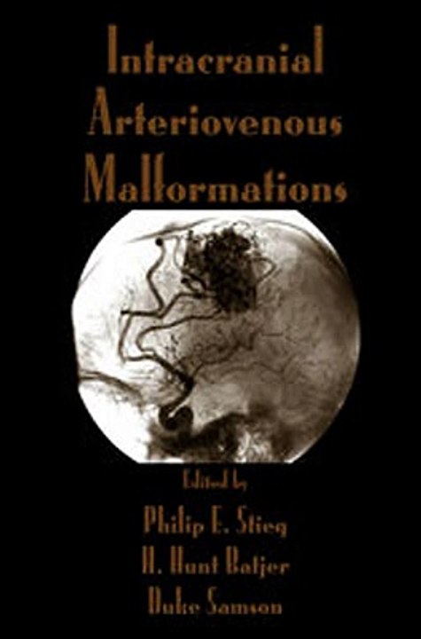 Download Intracranial Arteriovenous Malformations Ebook {EPUB} {PDF} FB2