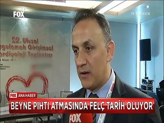 Beyne pıhtı atmasında felç kalmayı tarihe karıştıran yeni yöntem